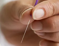 acupuncture img 3<br />
